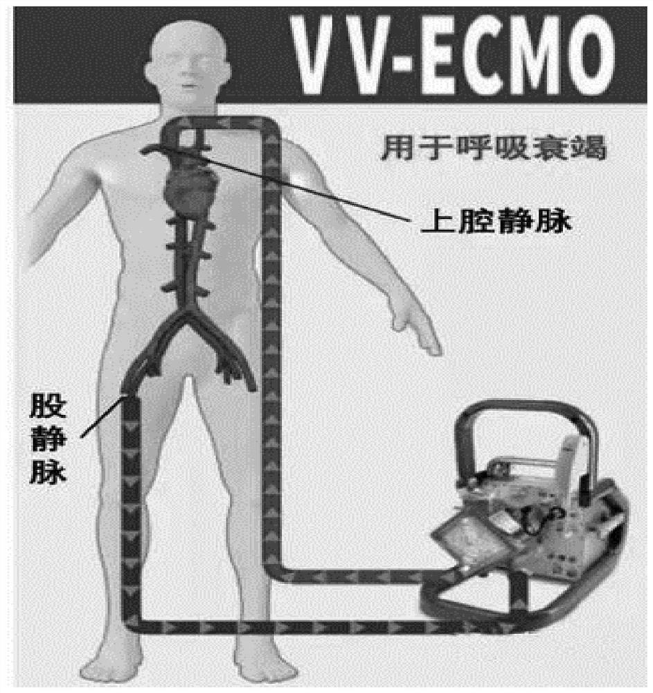 Venous cannula with balloon