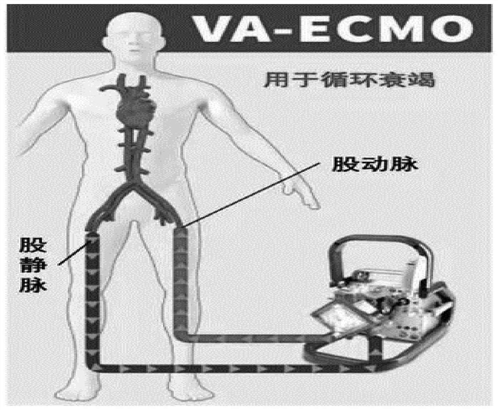 Venous cannula with balloon