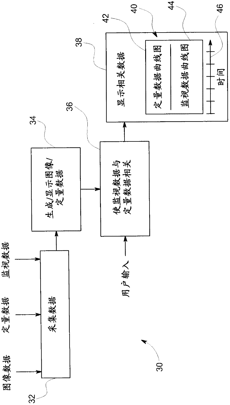 Method and system for displaying ultrasound data