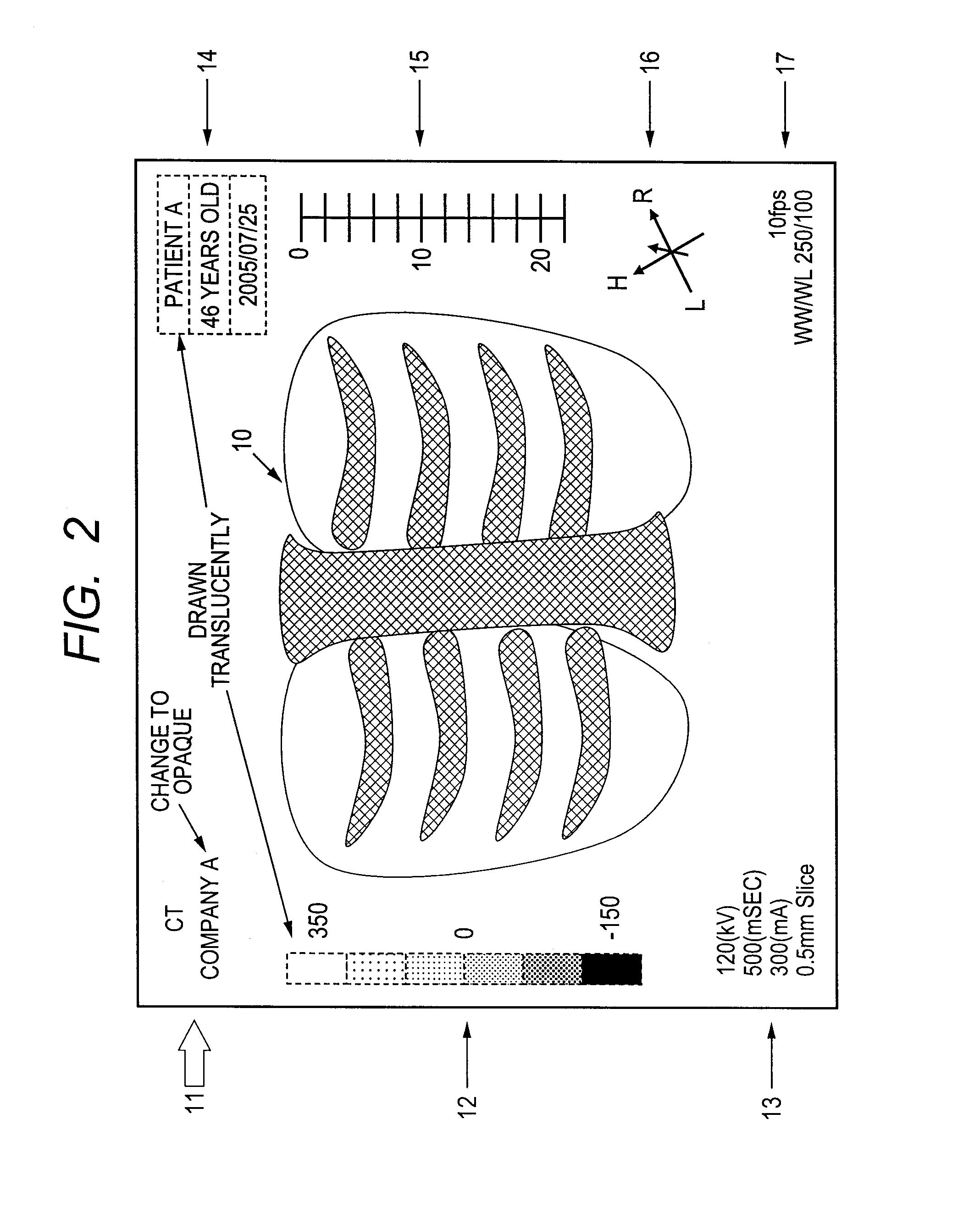 Image processing method and computer readable medium for image processing