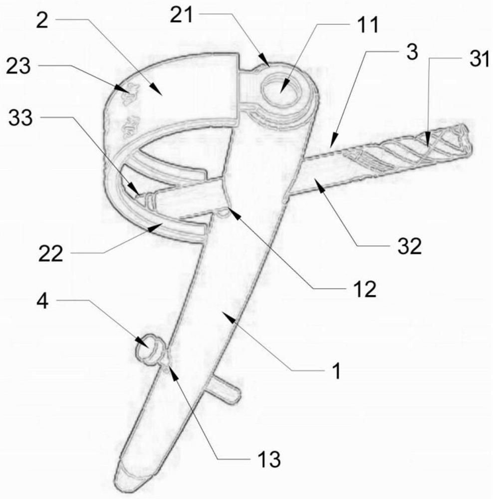 A kind of internal fixation for treating femoral intertrochanteric fracture combined with lateral wall fracture