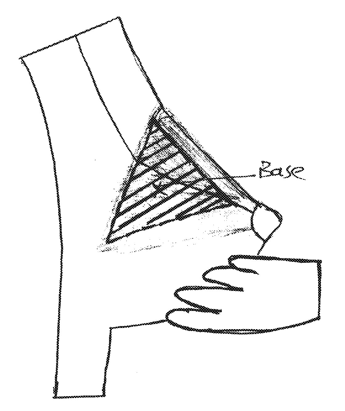 Pyramid-shaped breast implant for breast augmentation and/or breast lift with a method of use and production of the same