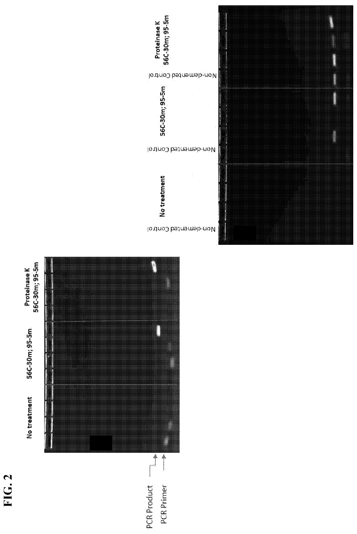 Methods for detection of microbial nucleic acids in body fluids