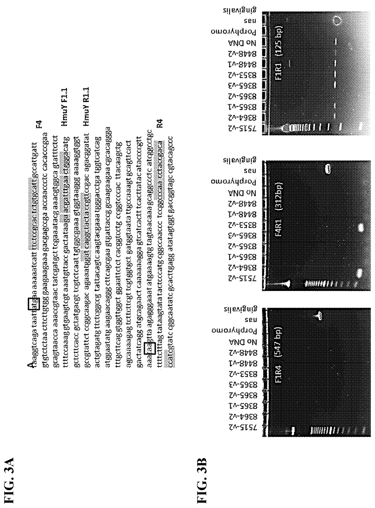 Methods for detection of microbial nucleic acids in body fluids