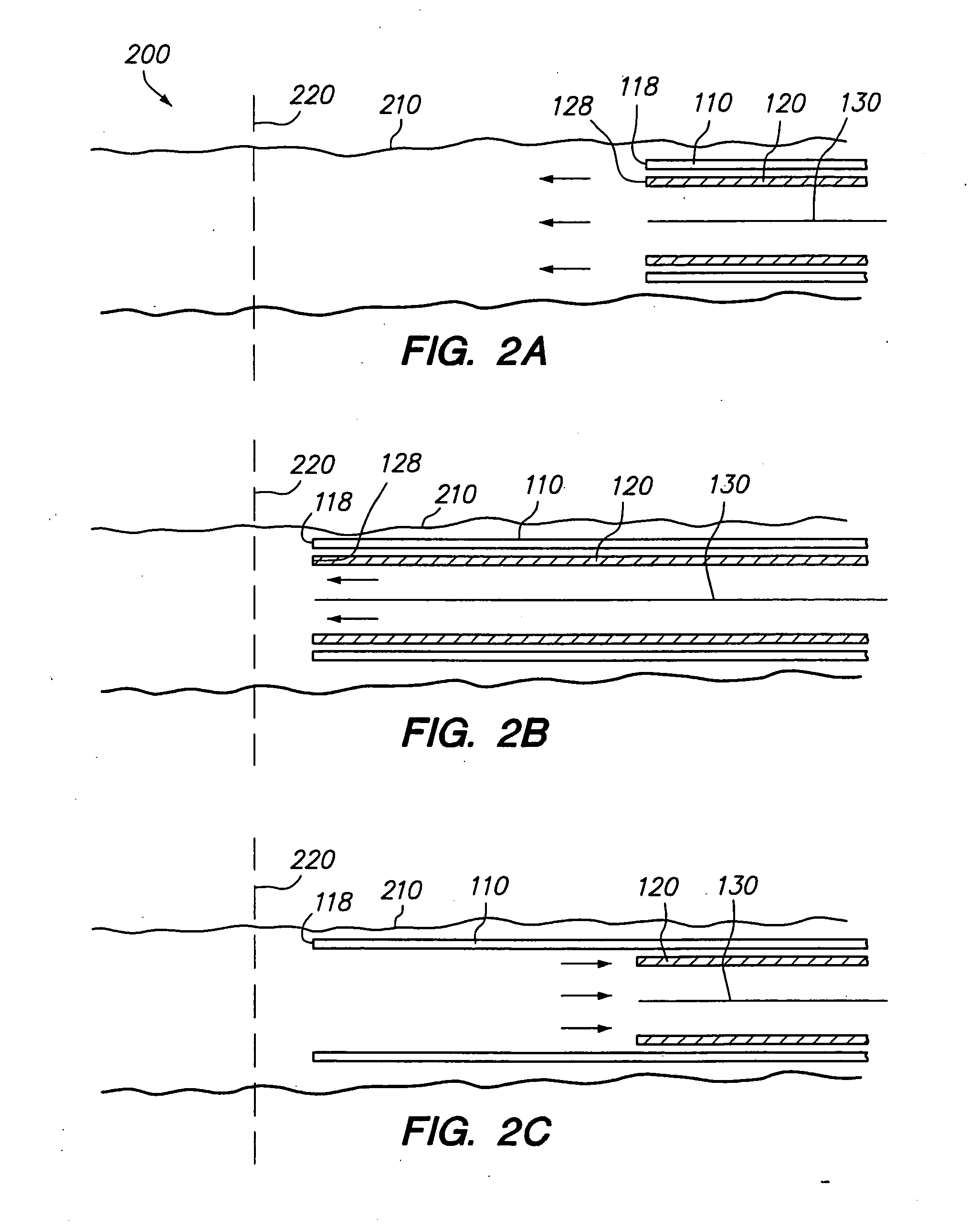 Method and system for delivering an implant utilizing a lumen reducing member
