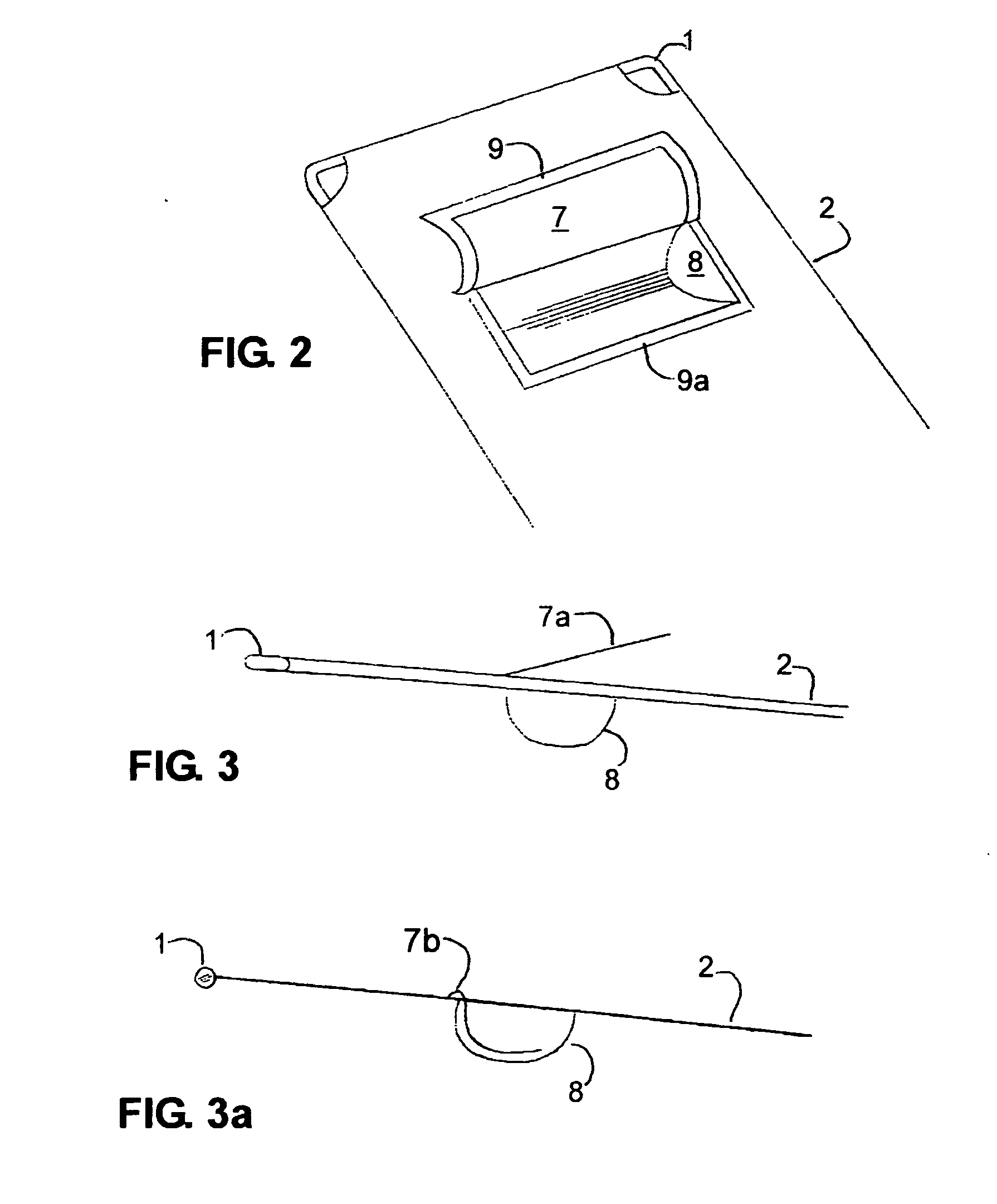 Breast/storage cavity 1