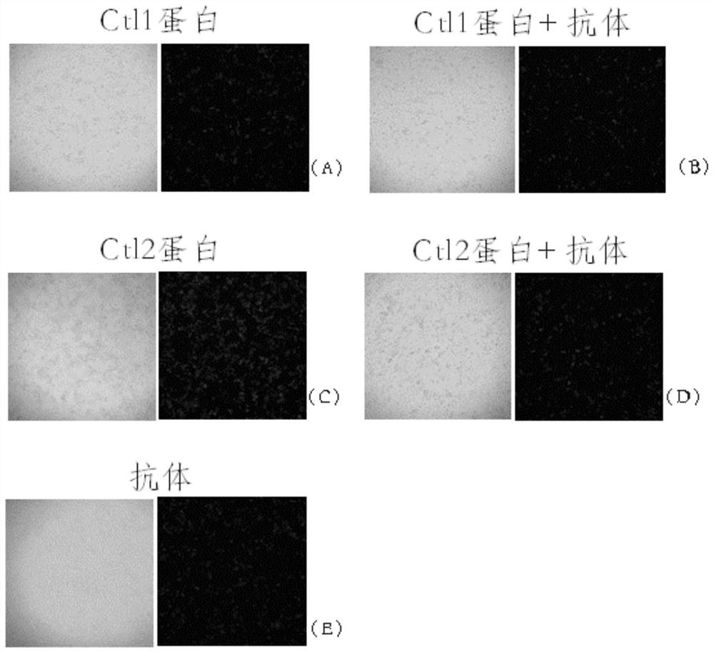 Application of flavobacterium columnare virulence protein in pathogen detection and low virulent strain preparation