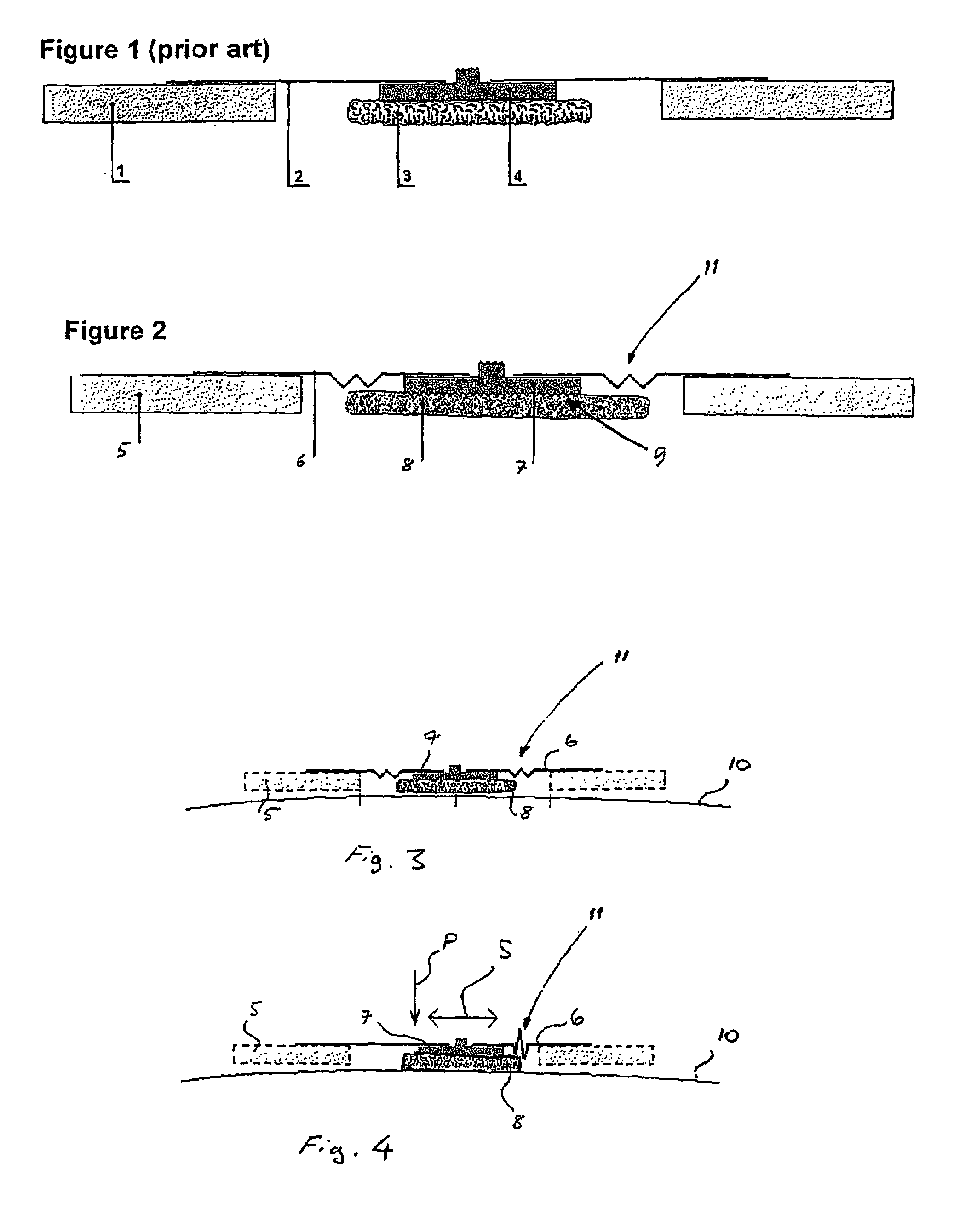 Electrode for obtaining a biopotential signal