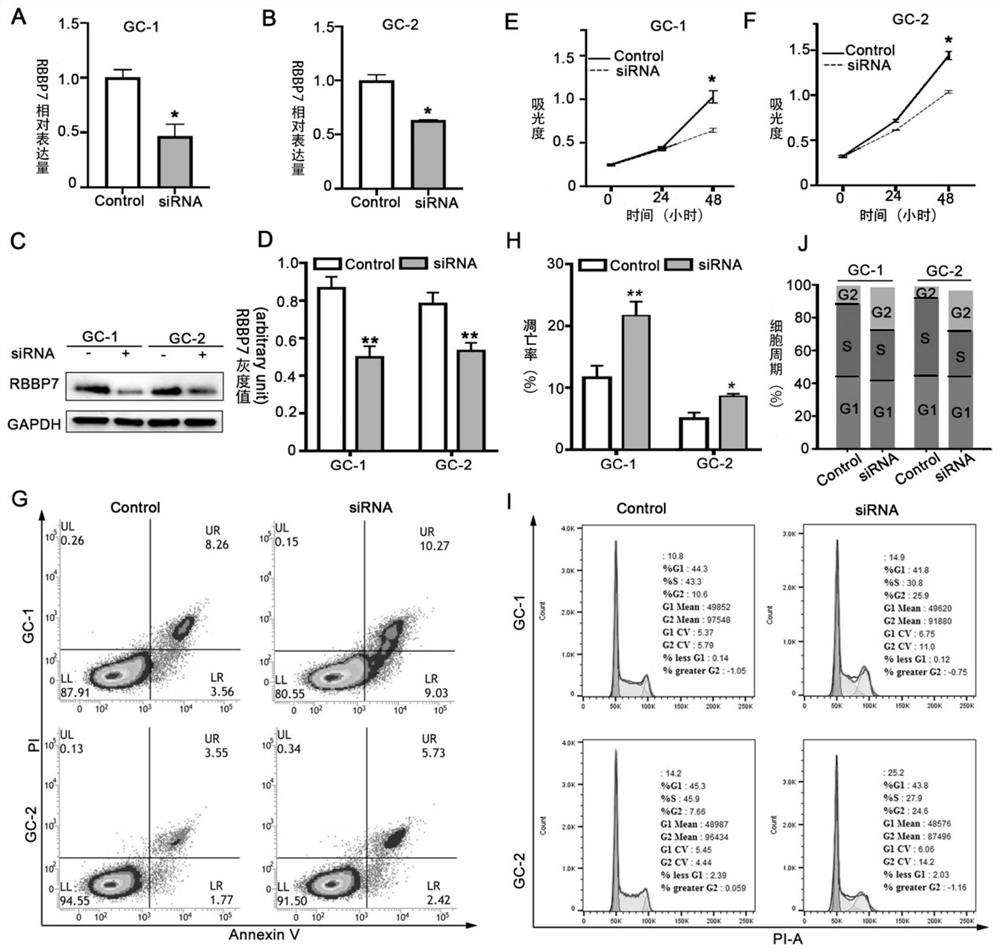 Application of RBBP7 gene/protein as drug target in preparation of products for diagnosing and treating male infertility diseases