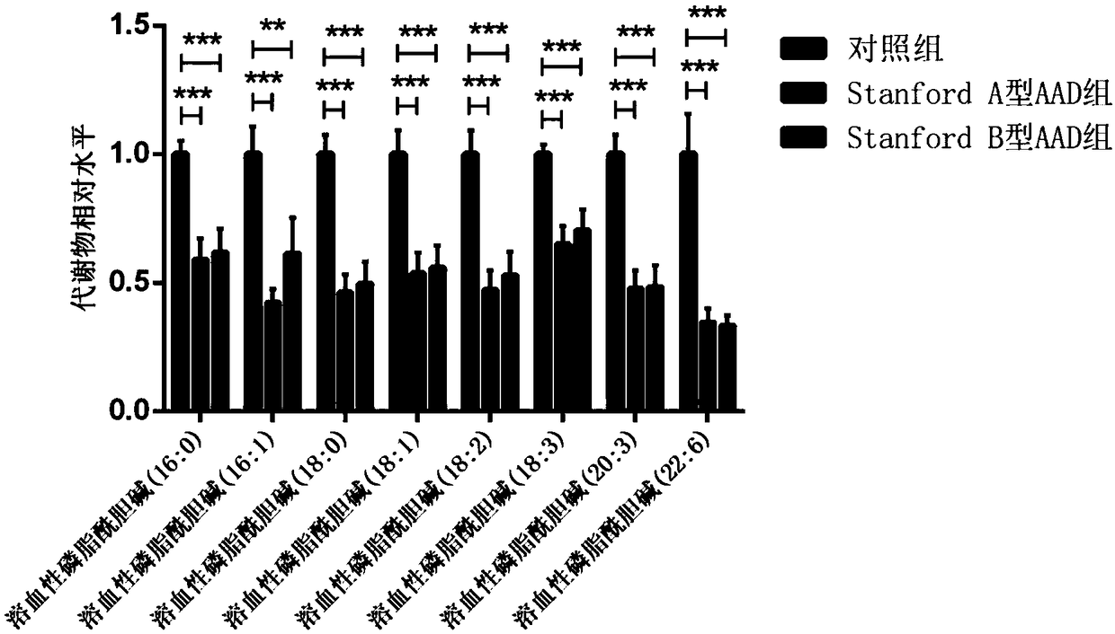 Method for establishing diagnostic criterion of acute aortic dissection