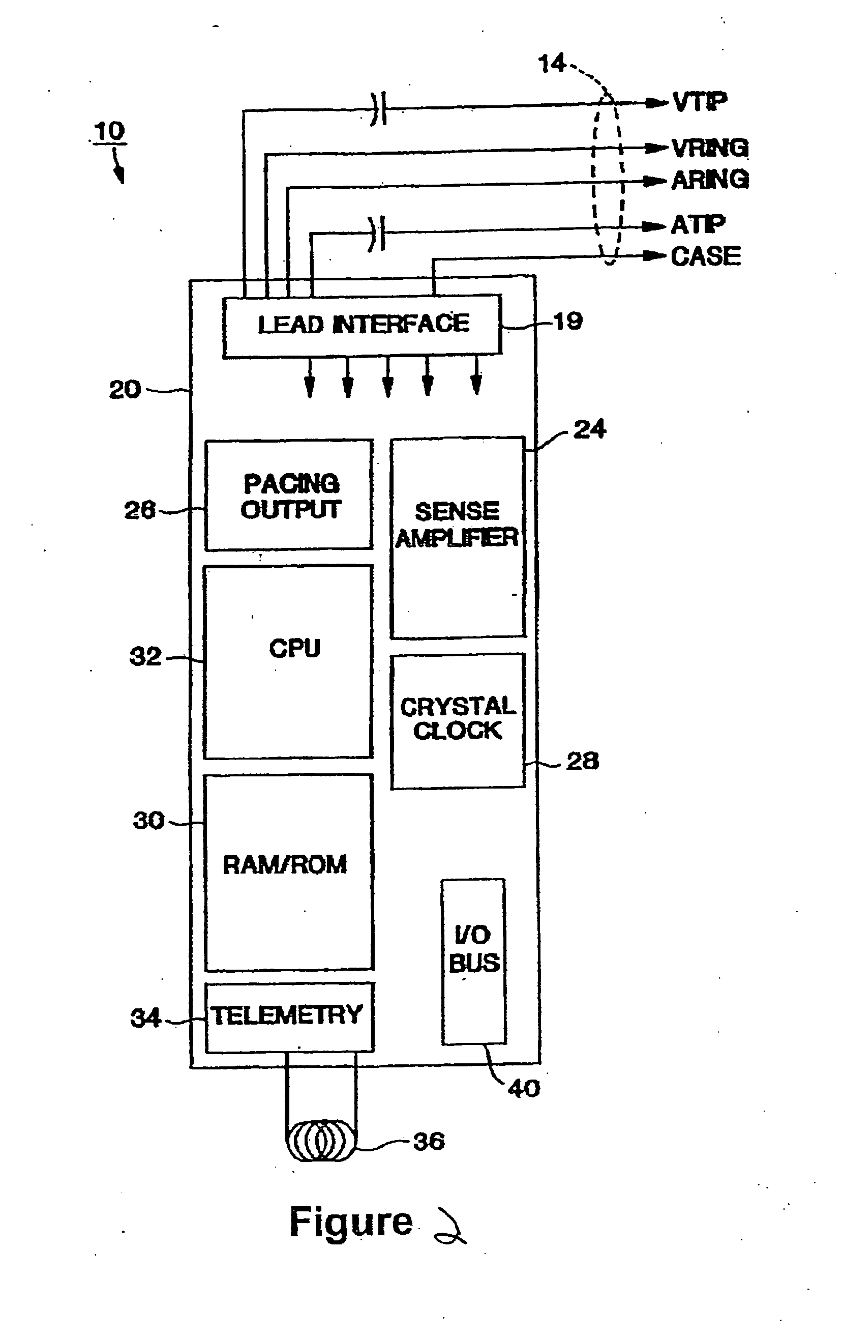 Implantable capacitive pressure sensor system and method