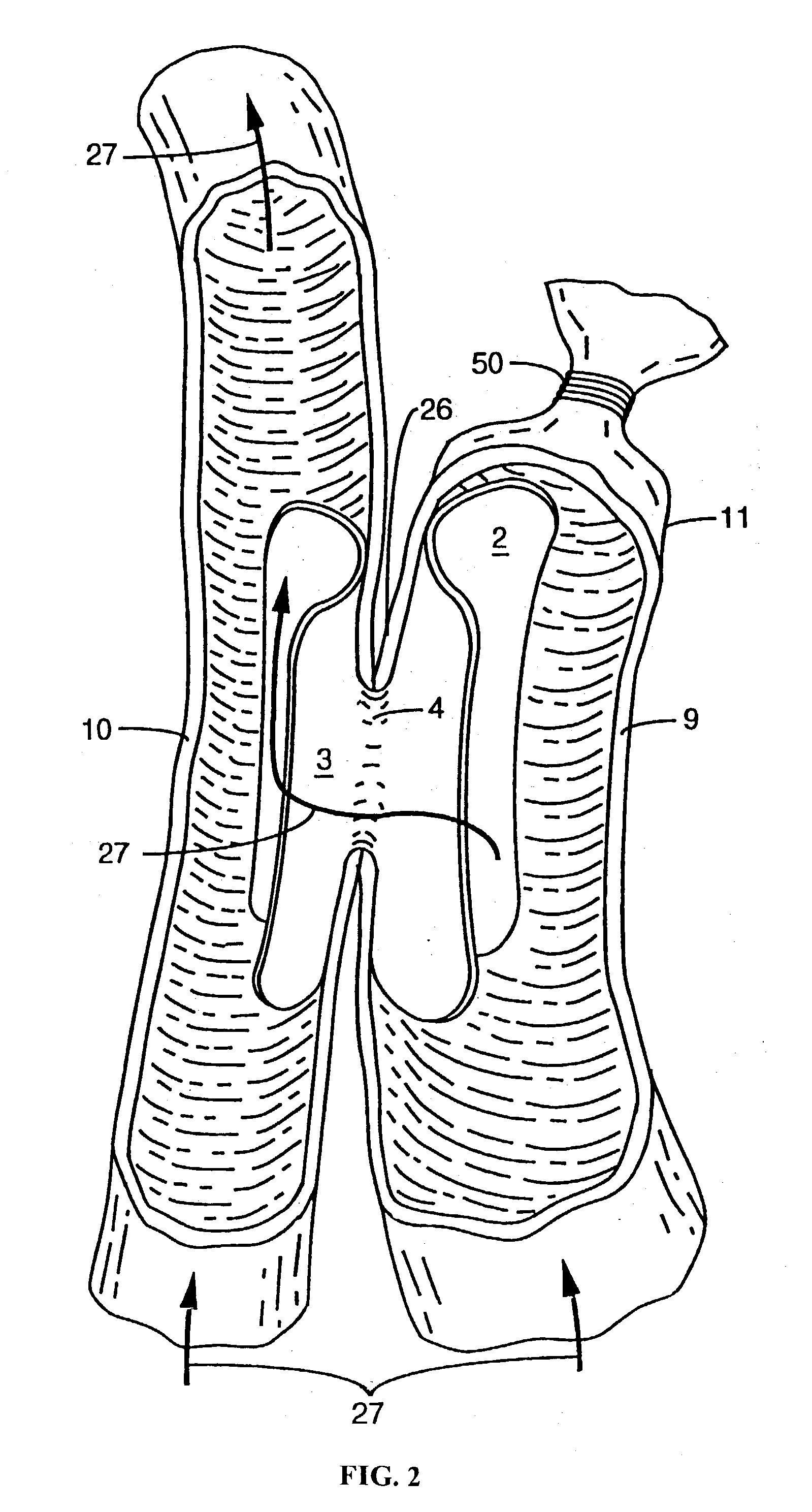 Devices and methods for interconnecting conduits and closing openings in tissue