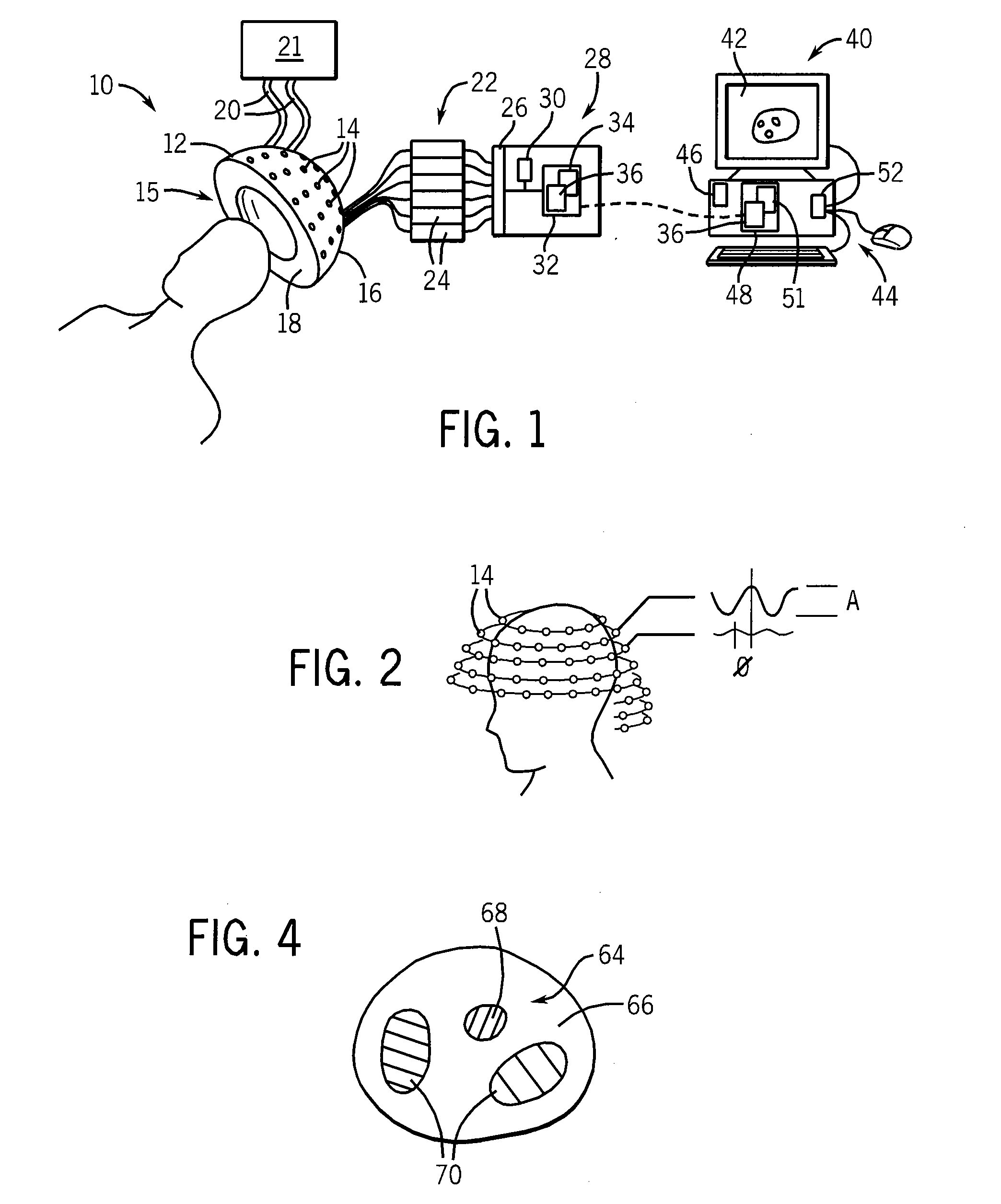 Microwave Hyperthermia Treatment System