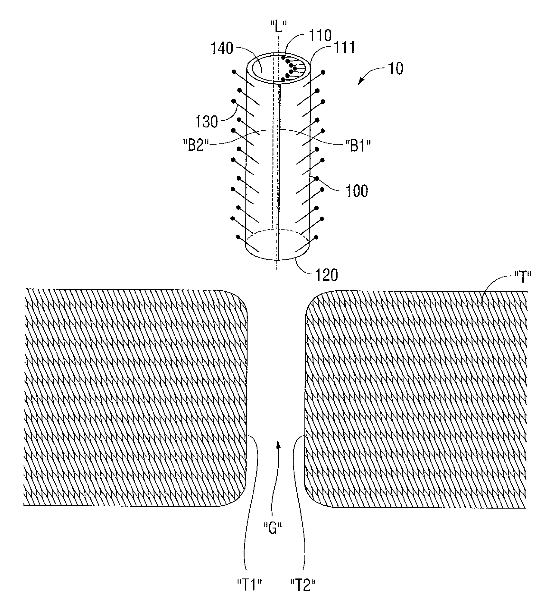 Wound closure device including progrip straw