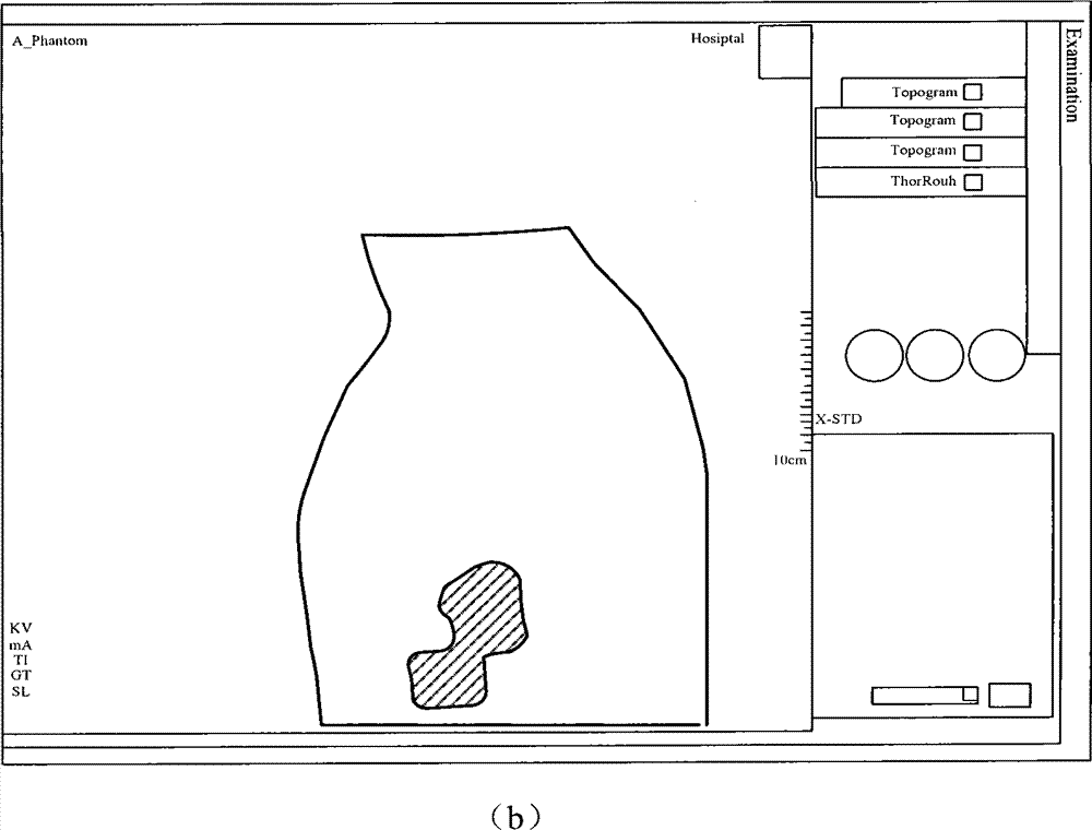 X-ray computed tomography scanning system and method