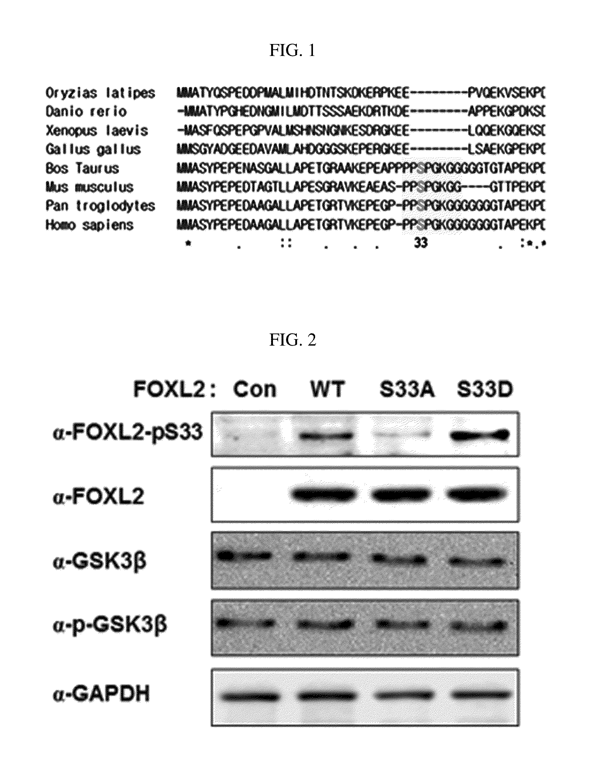 Pharmaceutical composition for preventing or treating ovary granulosa cell tumors containing glycogen synthase kinase-3 beta inhibitor as active ingredient, and functional health food composition