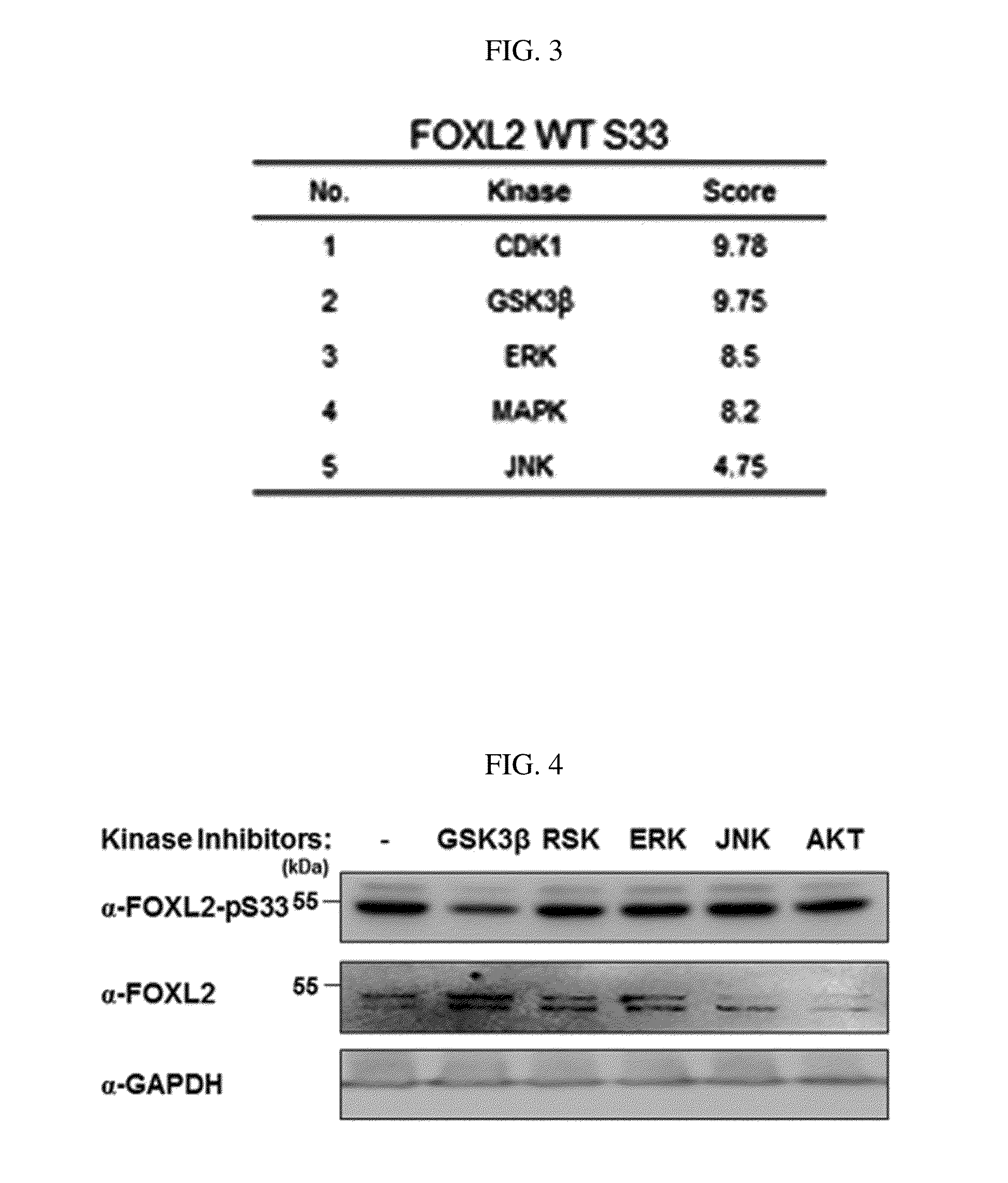 Pharmaceutical composition for preventing or treating ovary granulosa cell tumors containing glycogen synthase kinase-3 beta inhibitor as active ingredient, and functional health food composition