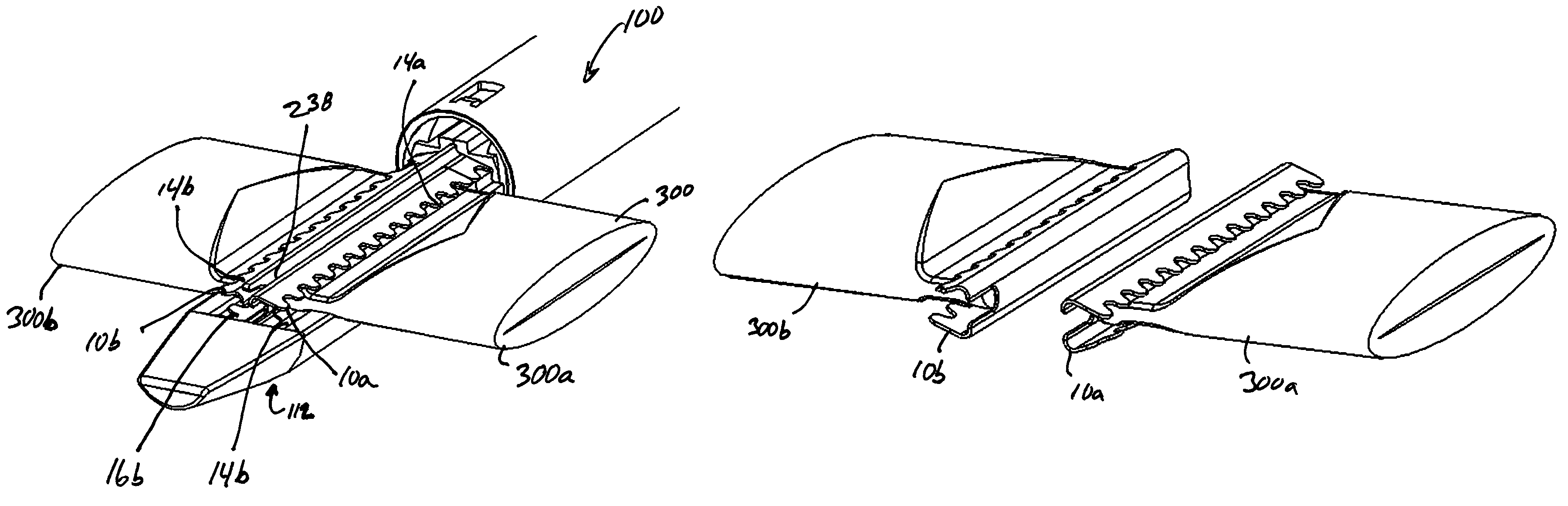 Surgical clip and applier device and method of use