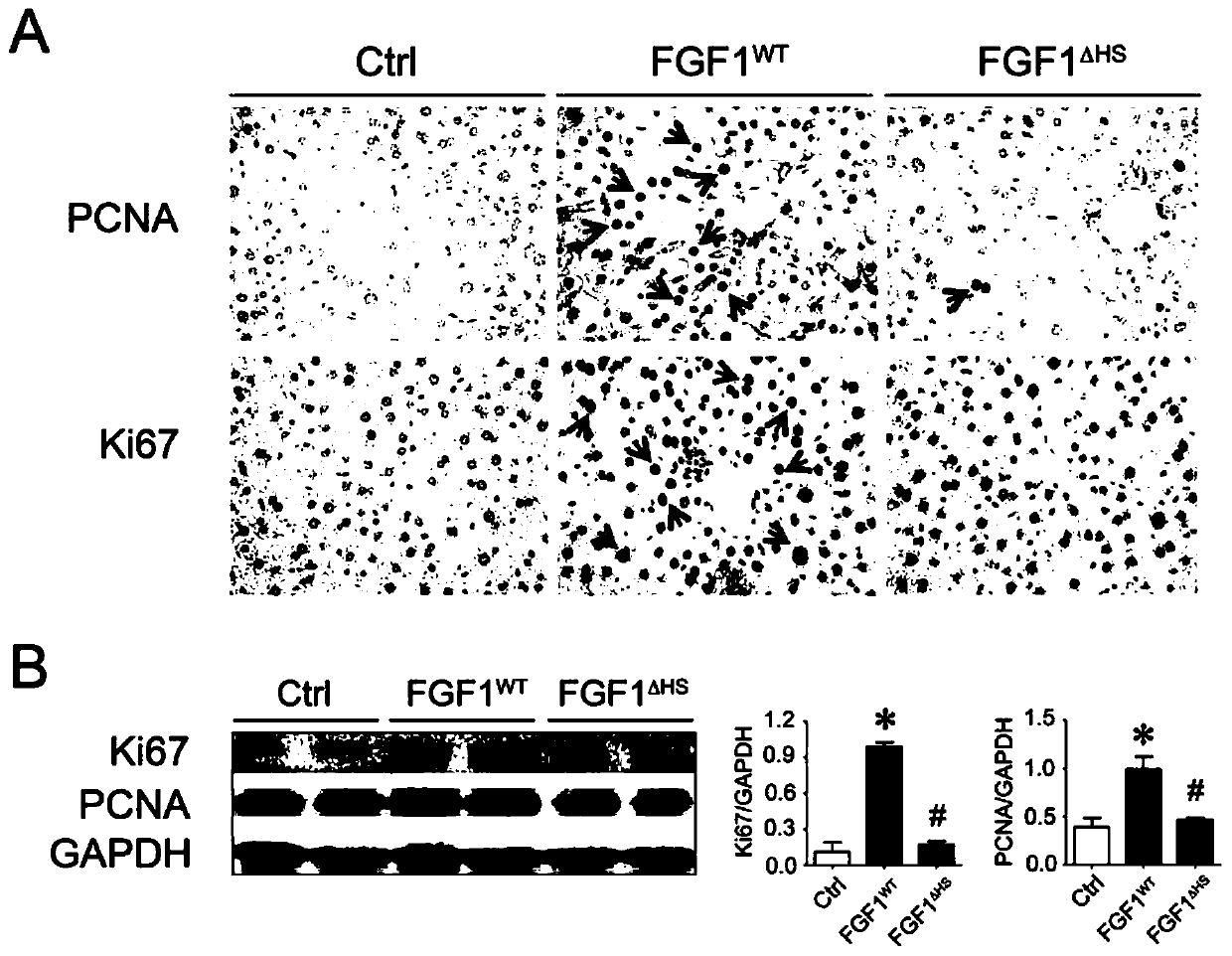 fgf1 mutant and its medical application
