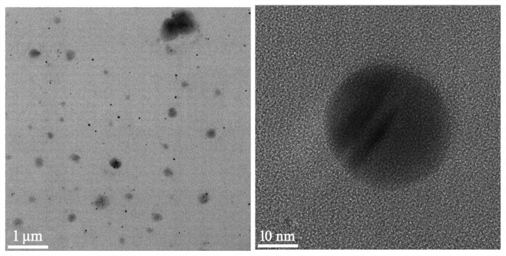 Antibacterial nano-silver/lignin polyurethane dressing and one-step method for preparing dressing