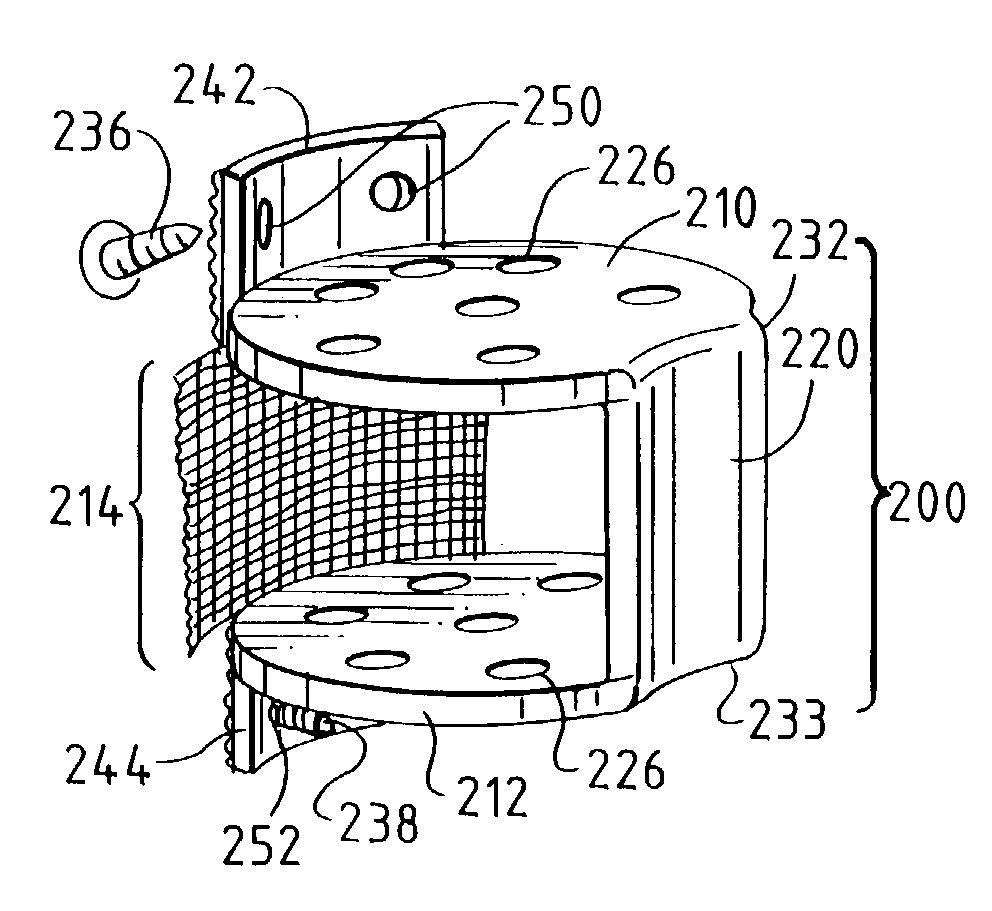 Cervical interbody device