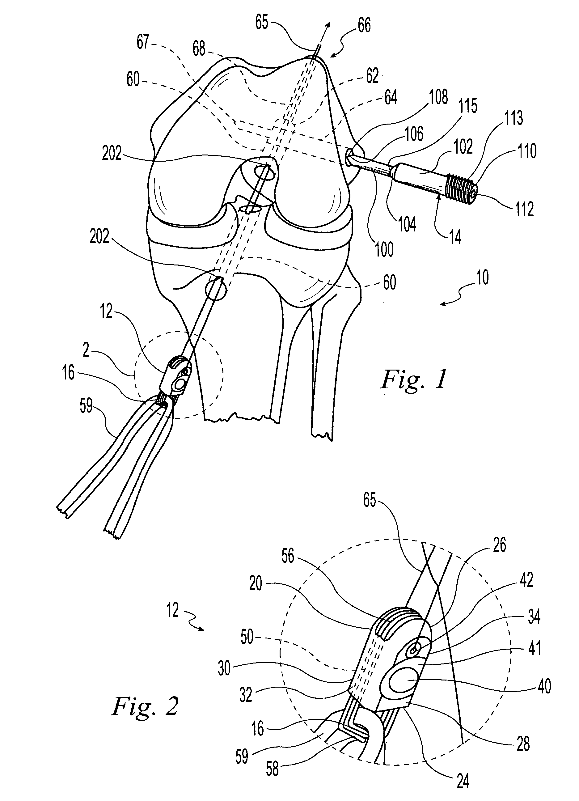 Cross-pin graft fixation, instruments, and methods