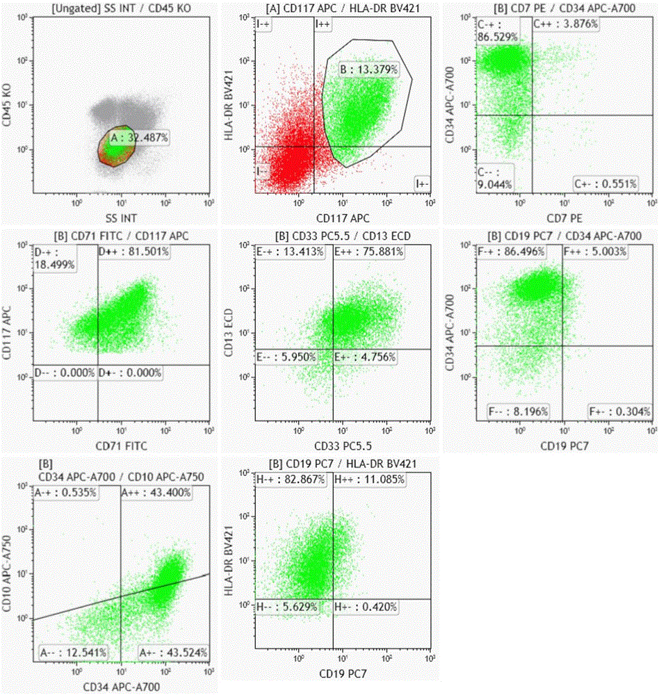 Ten-color antibody composition and application thereof in leukemia-lymphomas subtype