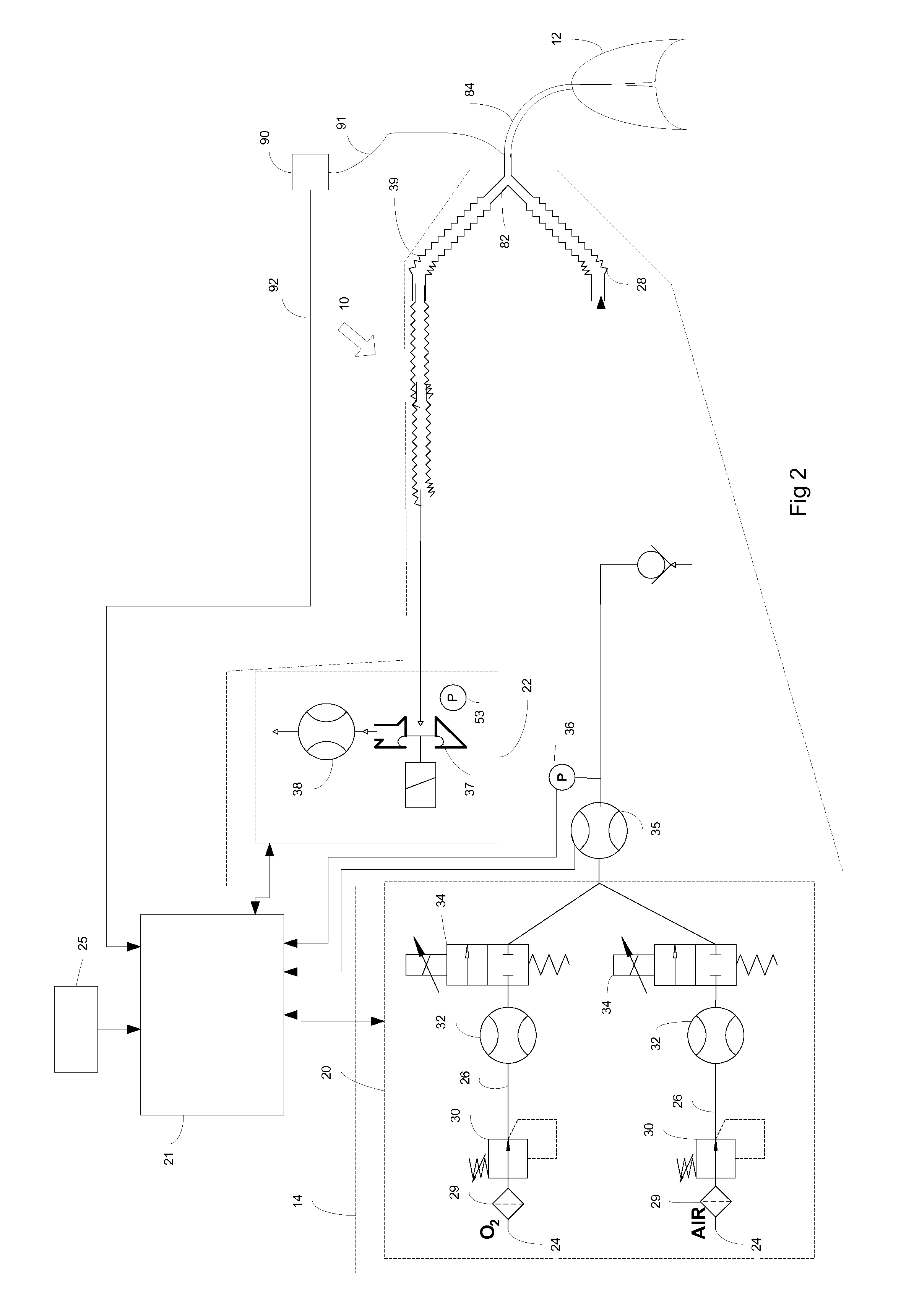 Method and arrangement for determining a ventilation need specific for a patient