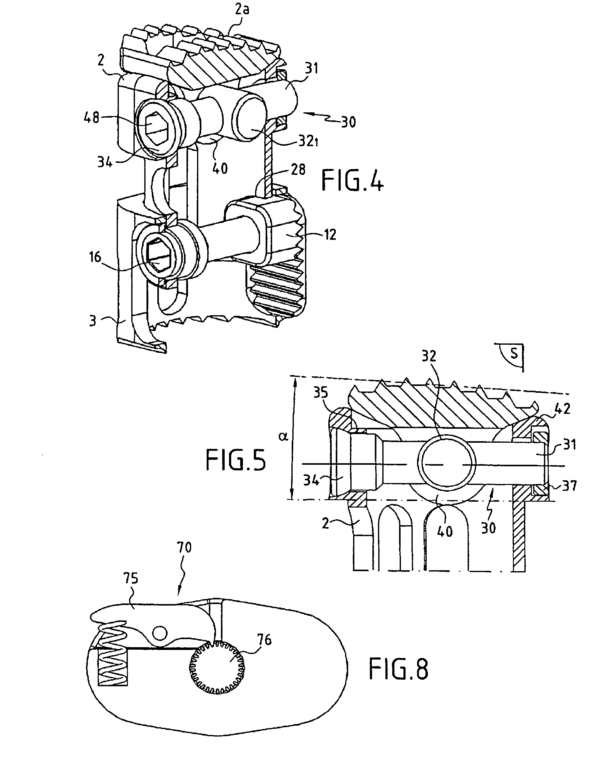 Vertebral replacement and distraction device for placing said implant