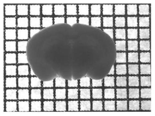 A treatment method for rapid tissue clearing based on water-soluble reagents and its application