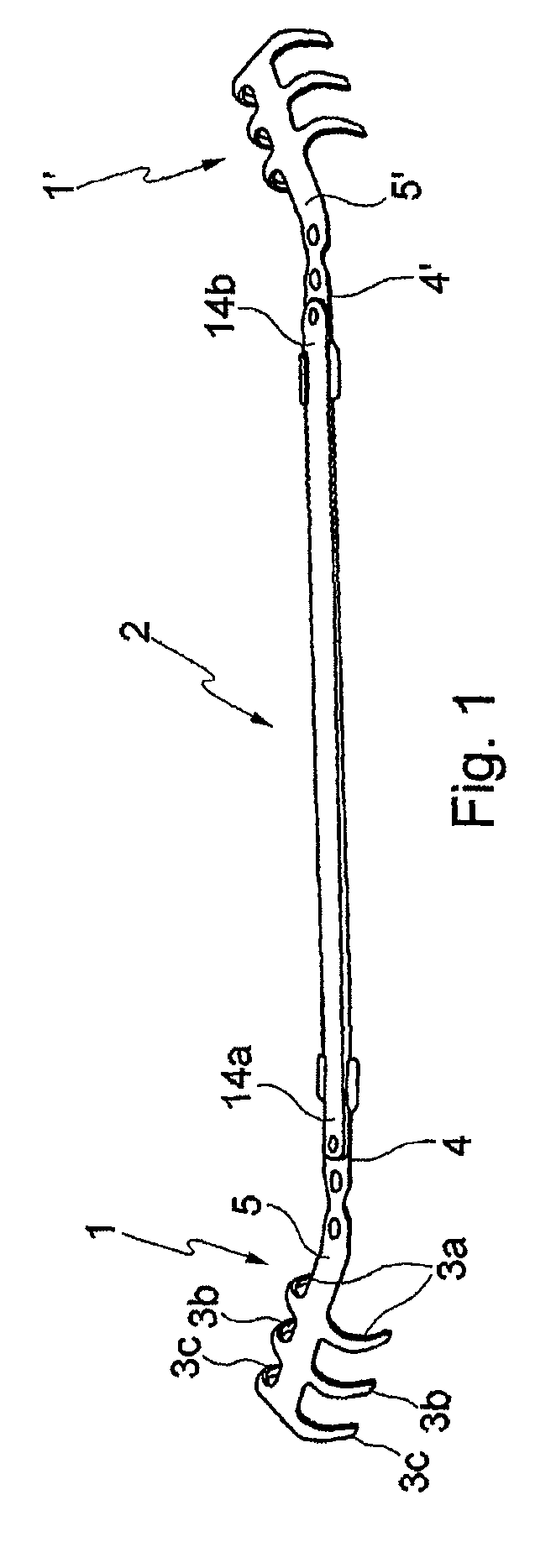 Implant, implant system, and use of an implant and implant system
