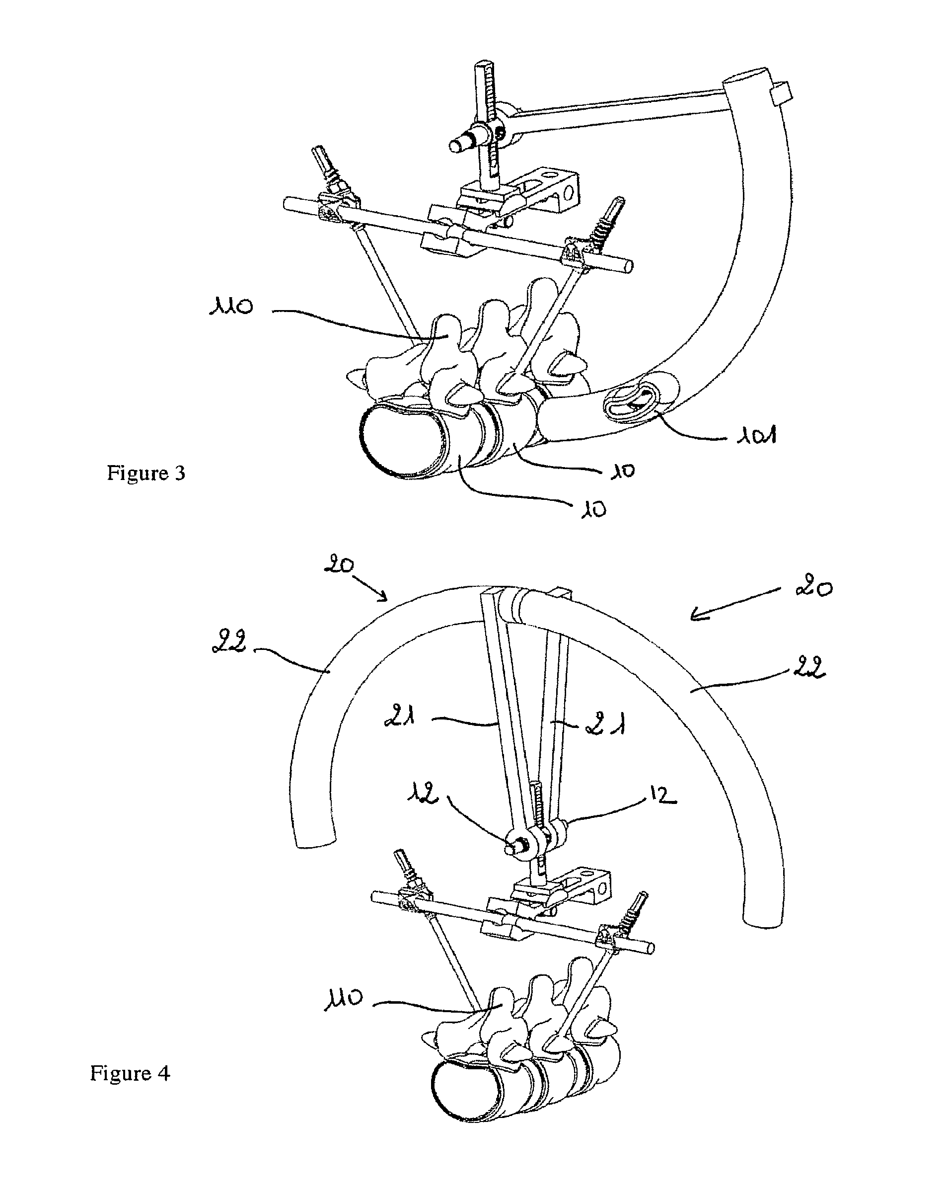 Device for Establishing an Anatomical Reference Point of an Intervertebral Disc