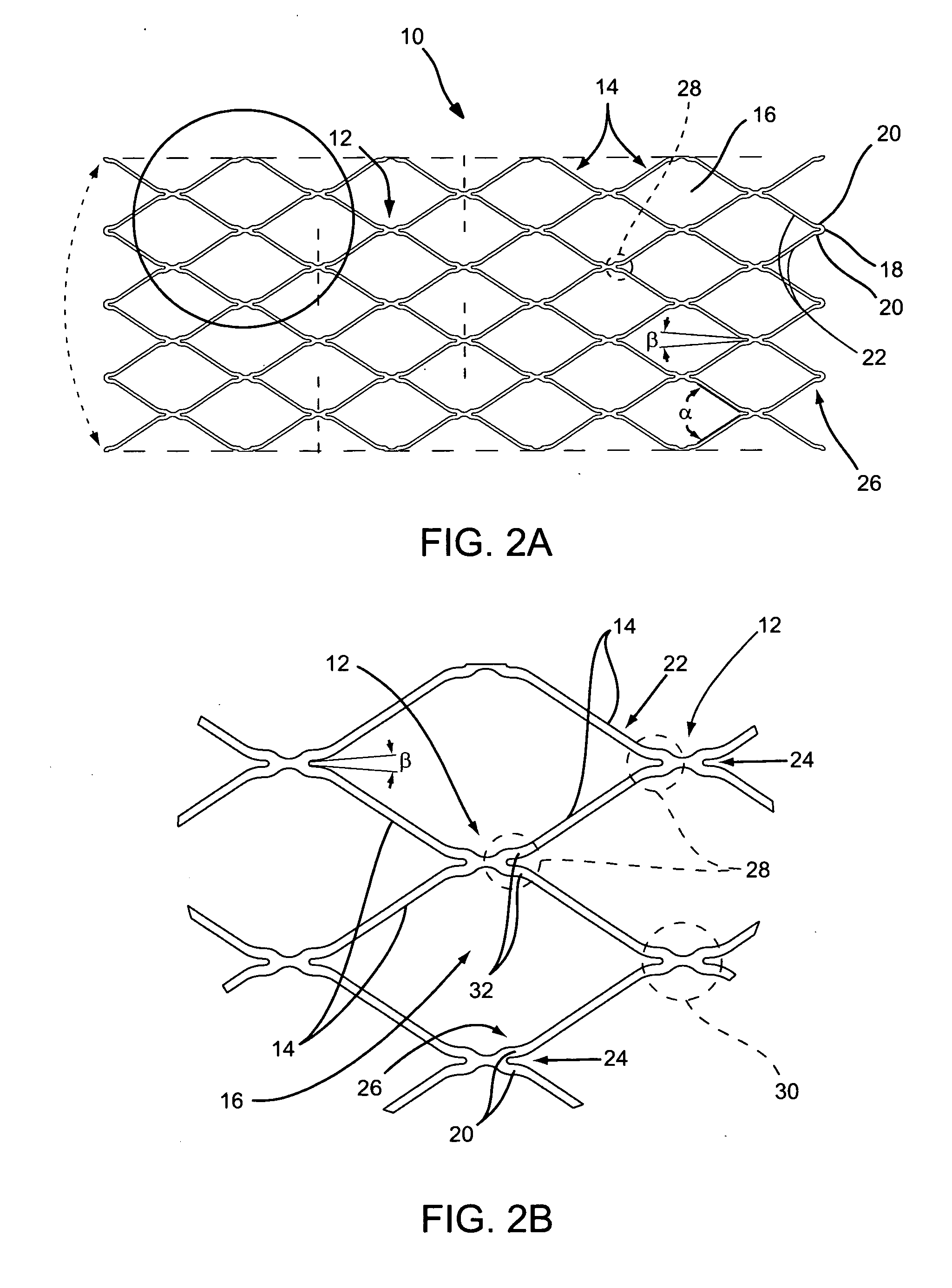 Stent delivery system