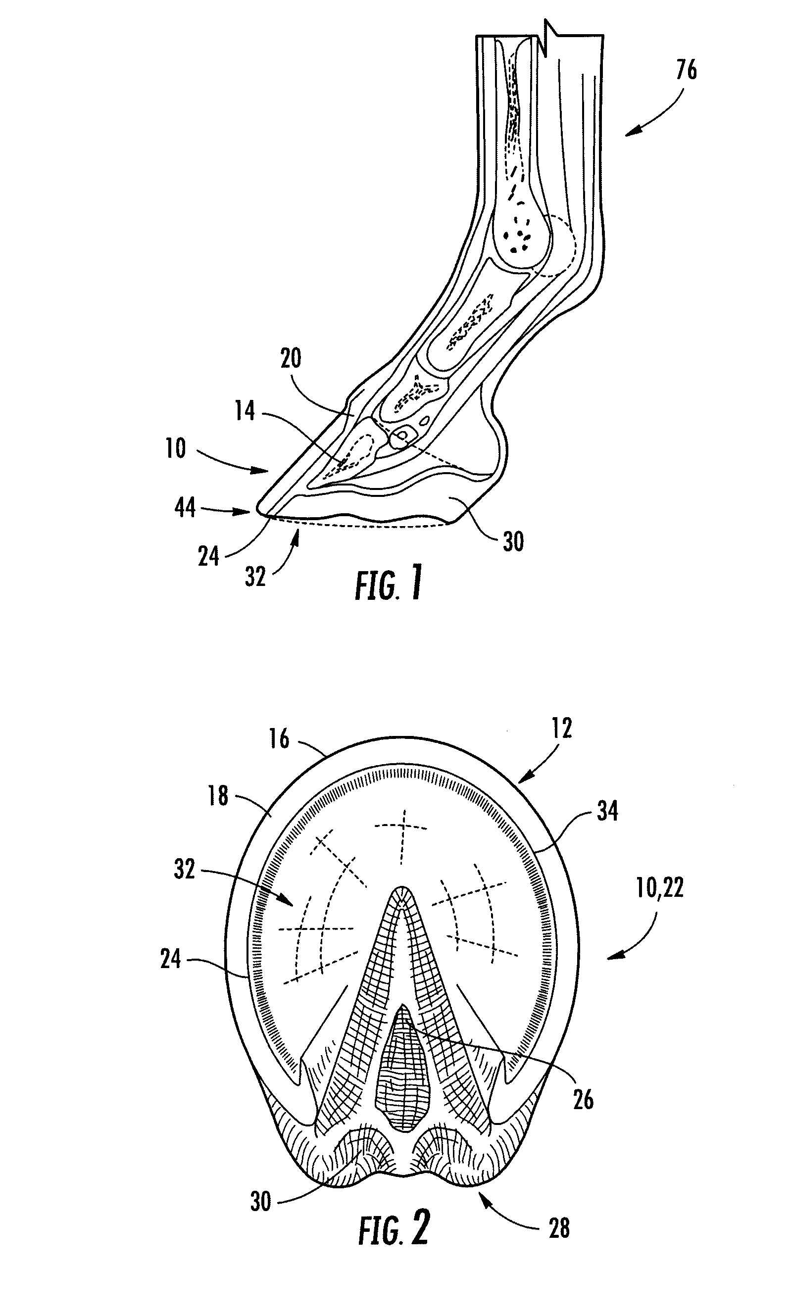 Cryotherapy device for treatment or prevention of laminitis in equine