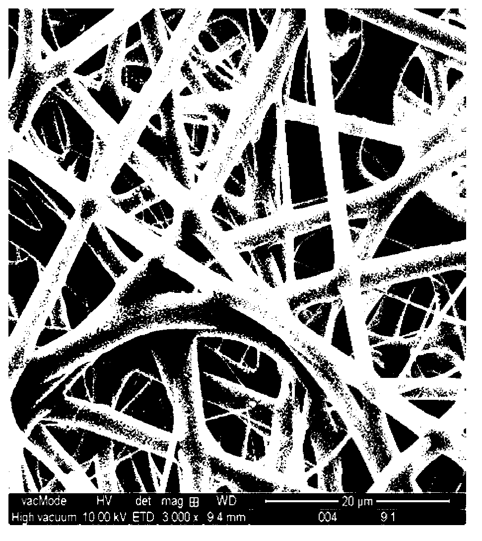 Electrostatic spinning preparation method for hybrid nanofiber membrane containing P(LLA-CL) and magnesium metal