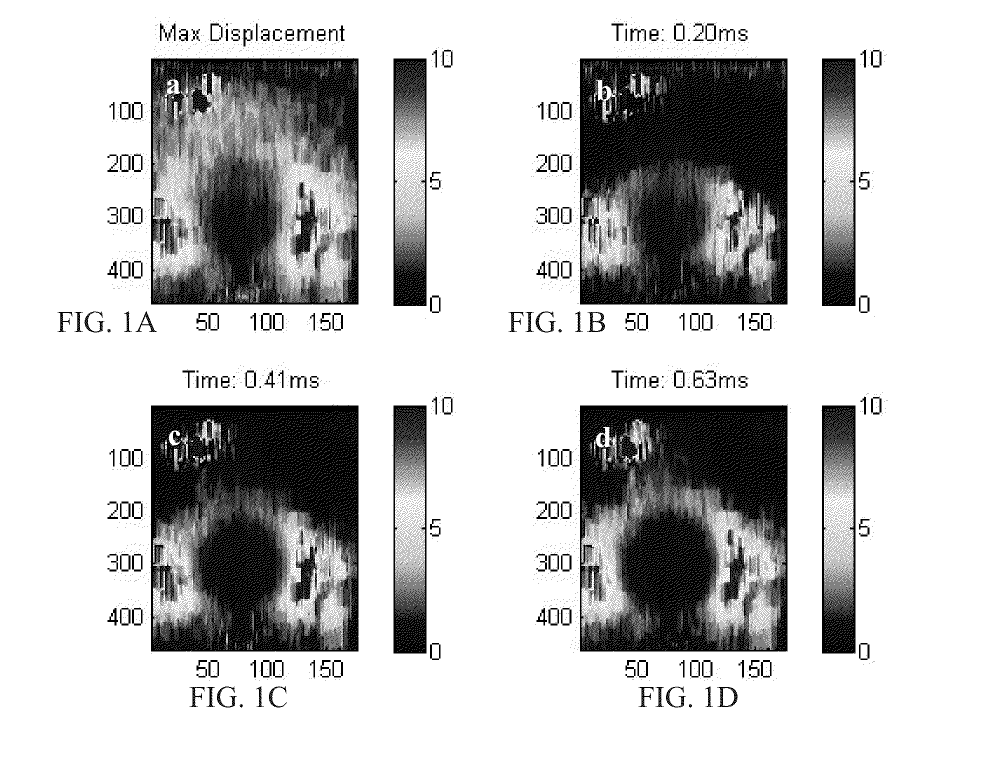 Ultrasound ARFI Displacement Imaging Using an Adaptive Time Instance