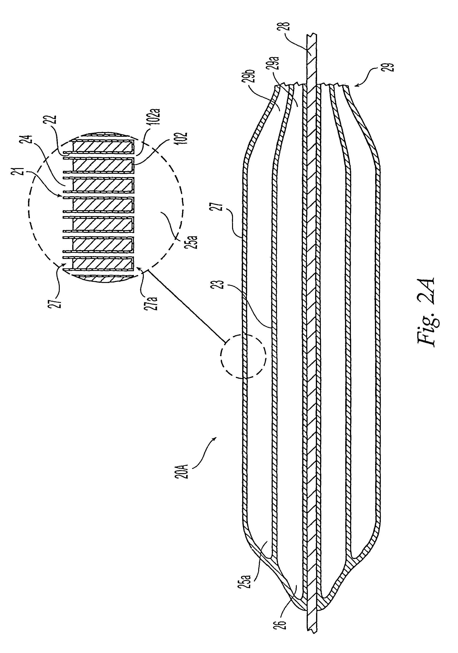 Medical device for delivery of a biologically active material to a lumen