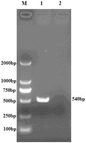 Porcine epidemic diarrhea, porcine delta coronavirus bivalent inactivate vaccine and preparation method thereof