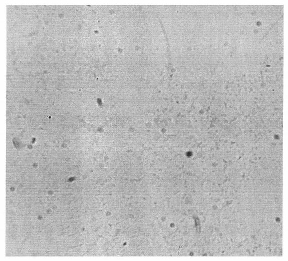 Maspin gene in-situ hybridization detection kit and detection method and use thereof