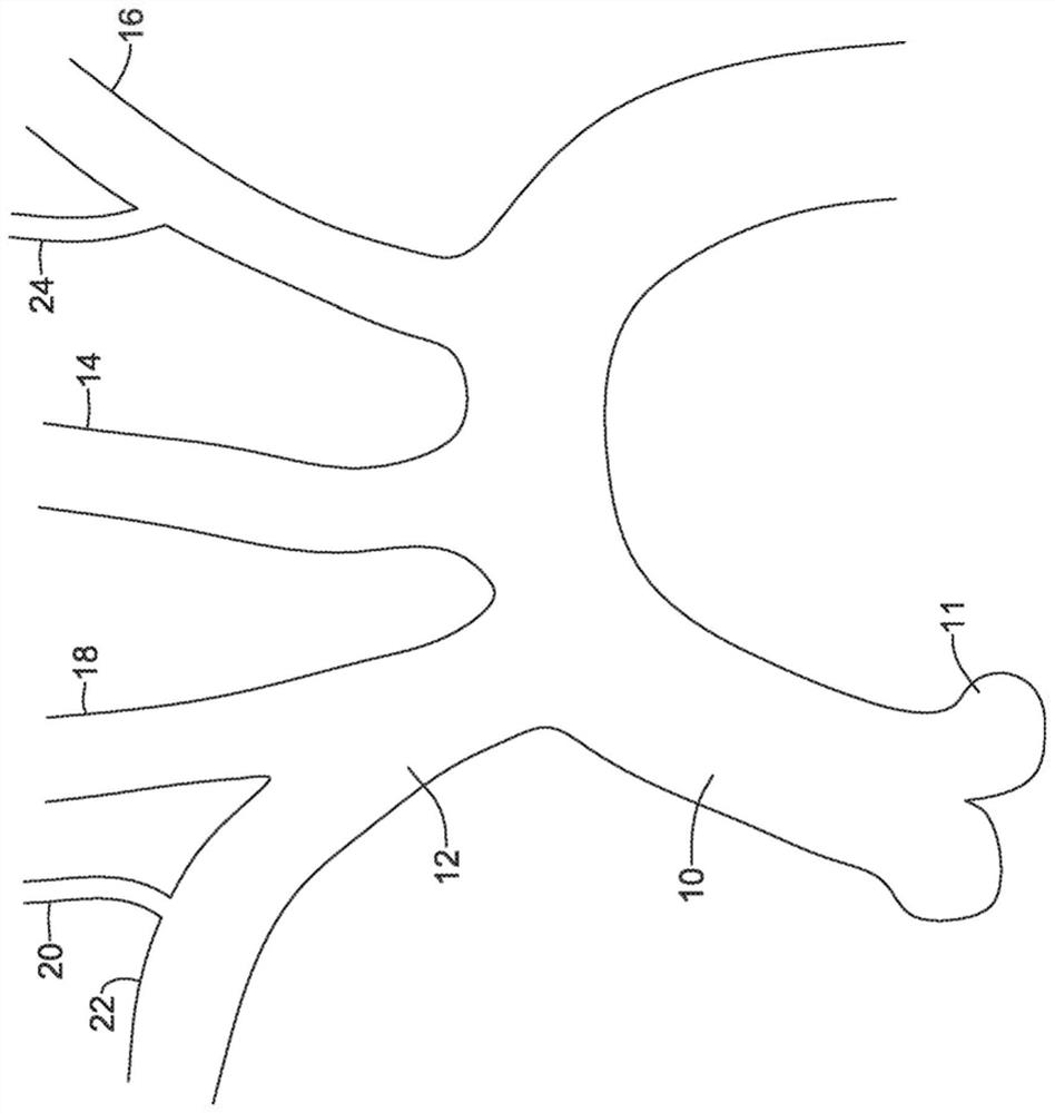 Systems for protecting the cerebral vasculature