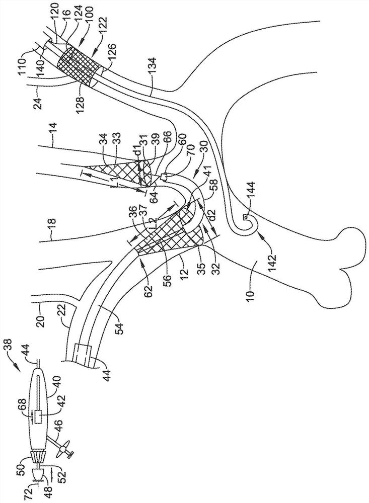 Systems for protecting the cerebral vasculature