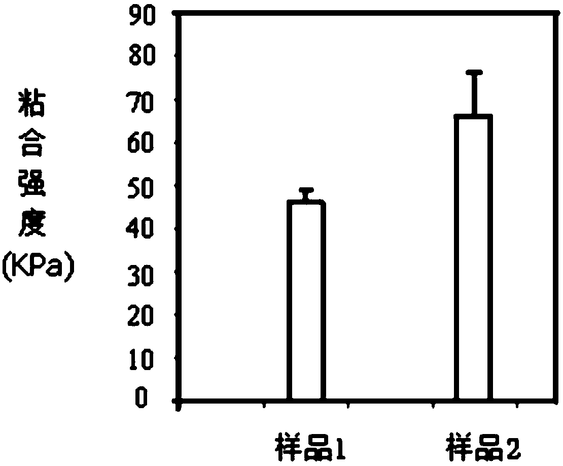 Chitosan-based hydrogel, and preparation method and application thereof