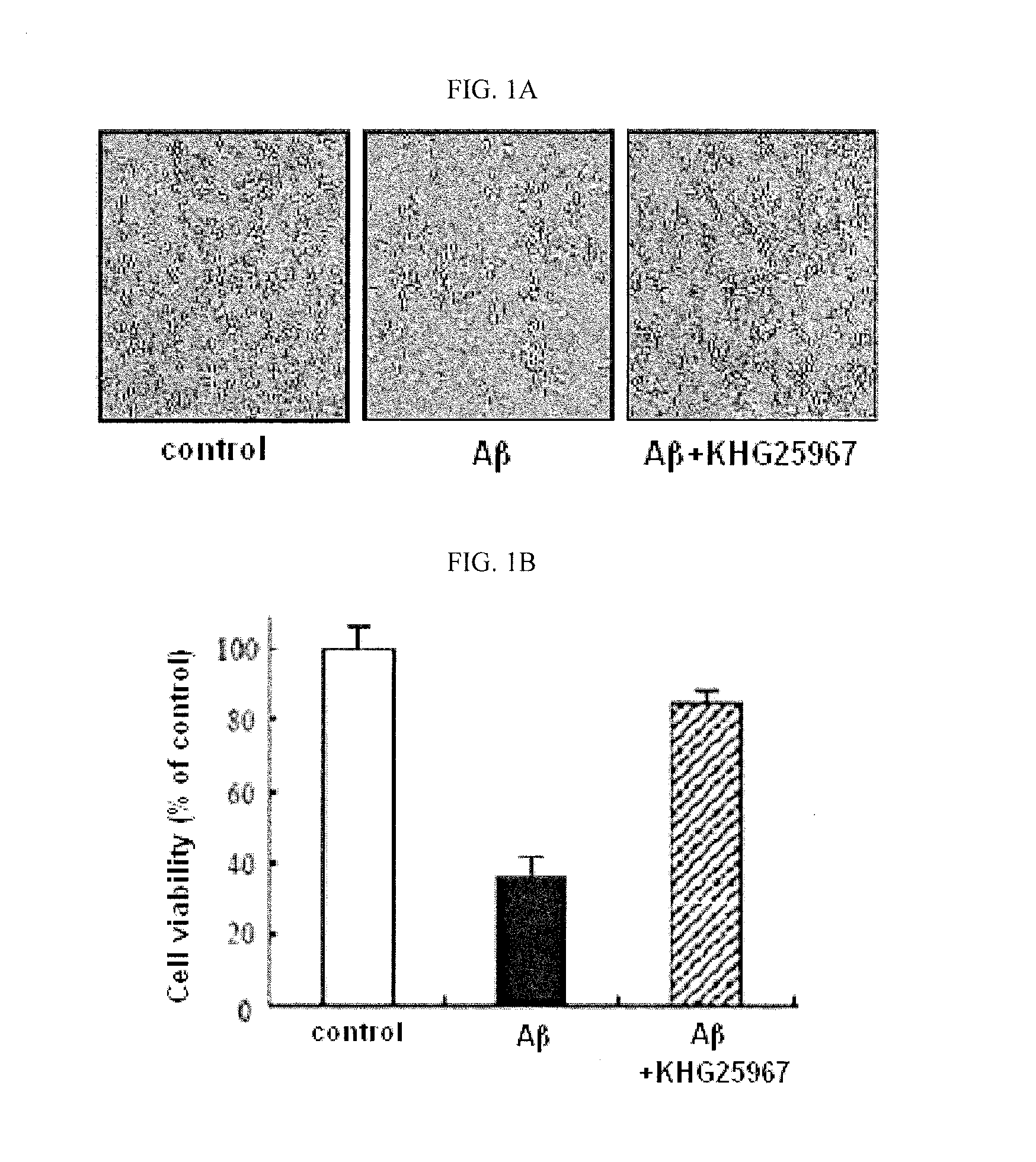 Benzoarylureido compounds, and composition for prevention or treatment of neurodegenerative brain disease containing the same
