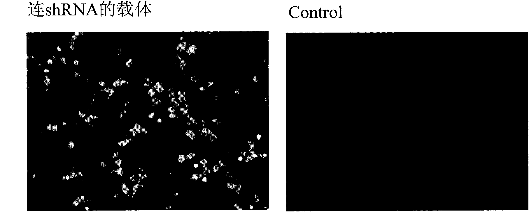 Anti-PCVD shRNA and design-synthesis method and application thereof