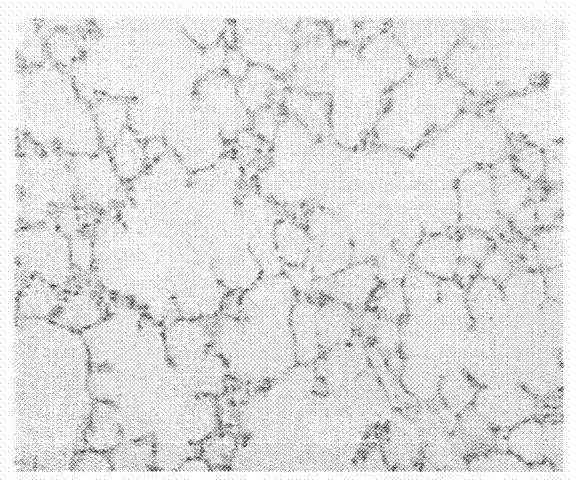 Application of semen astragali complanati general flavone extract in the preparation of pulmonary fibrosis prevention drugs