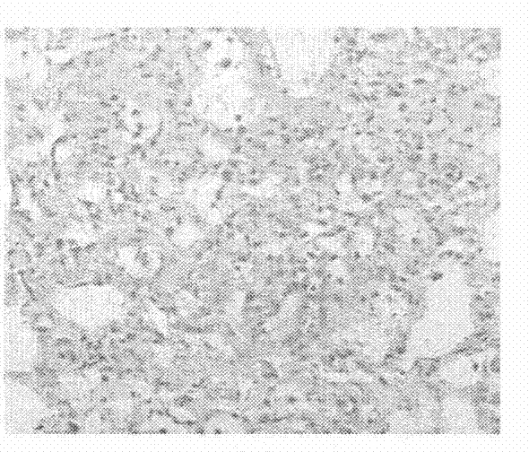 Application of semen astragali complanati general flavone extract in the preparation of pulmonary fibrosis prevention drugs