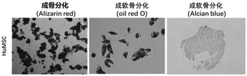 Serum-free umbilical cord mesenchymal stem cell composition and application thereof