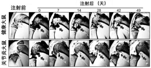 Serum-free umbilical cord mesenchymal stem cell composition and application thereof