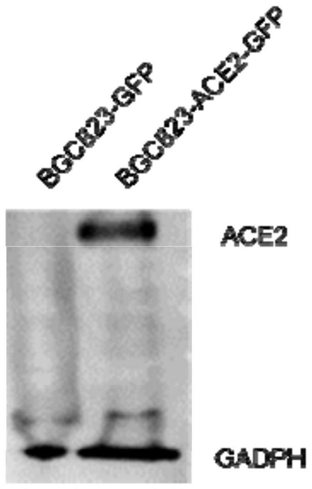ACE2 cell humanized mouse model as well as construction method and application thereof