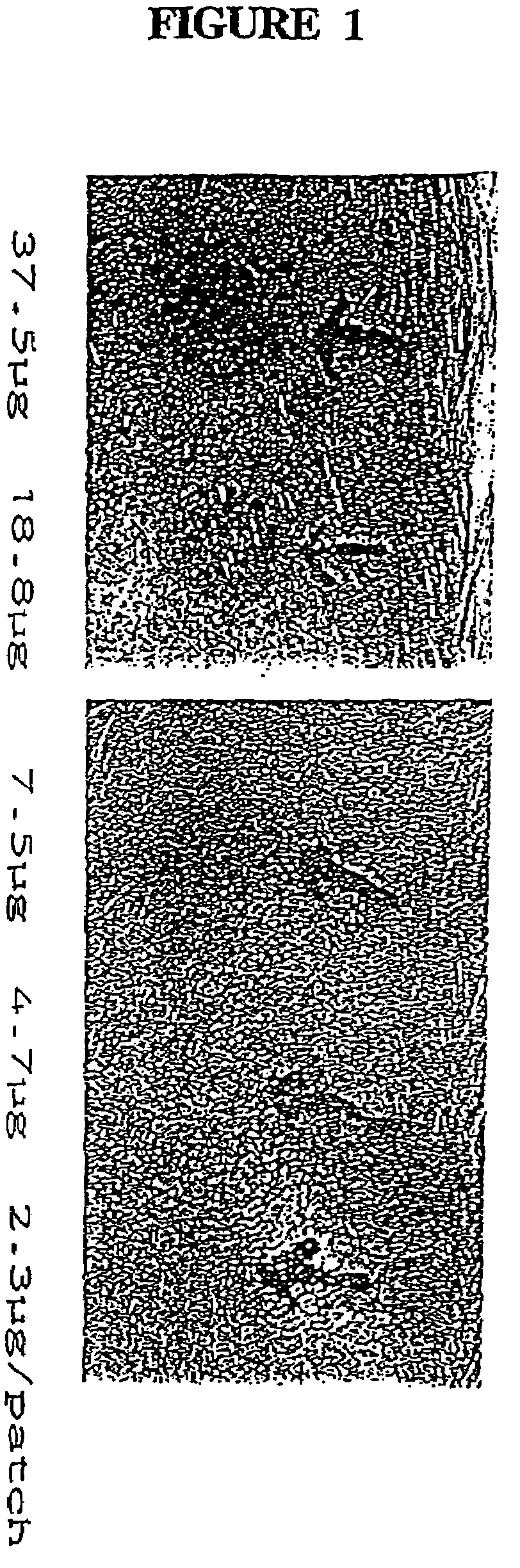 Methods and compositions for detection and diagnosis of infectious diseases